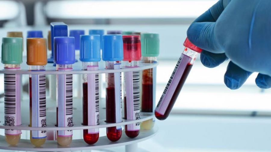 Equipos de laboratorio